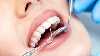 61ae15ceefbd14f1e8c37ad4_female-dentist-teeth-examination