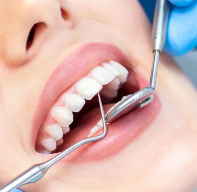 61ae15ceefbd14f1e8c37ad4_female-dentist-teeth-examination