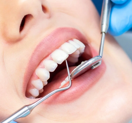 61ae15ceefbd14f1e8c37ad4_female-dentist-teeth-examination